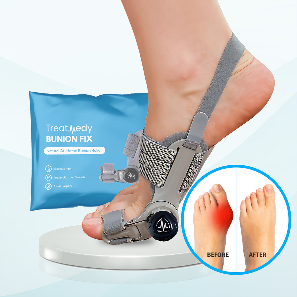 Treatmed Bunion Fix