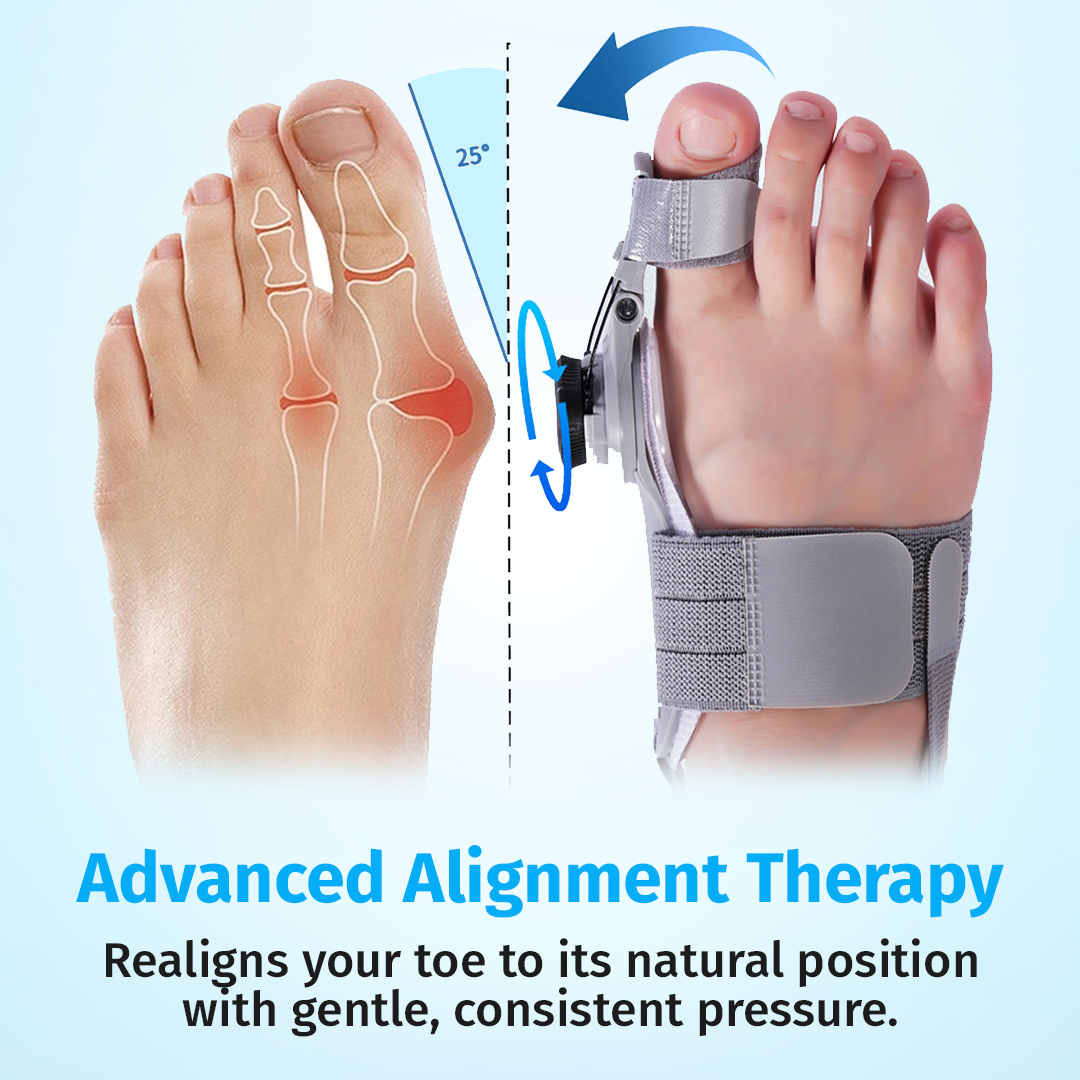 Treatmed Bunion Fix
